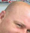 Alphadog79